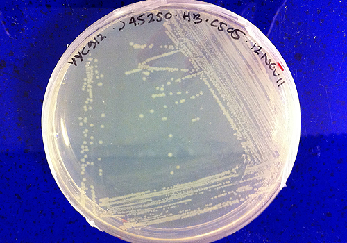 Banana Bacteria (2011), &nbsp;Plate of indole inefficent&nbsp;E.coli&nbsp;strain transformed with plasmid.