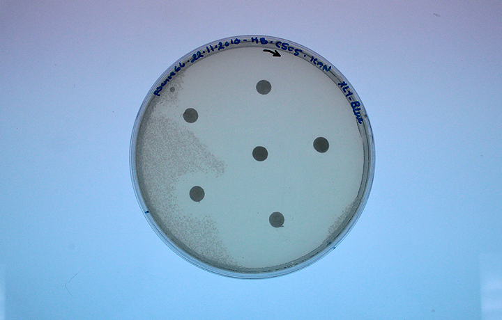 Howard Boland, 'katE', 2010 – Disks dipped in varying concentrations of hydrogen peroxide demonstrate how bacterial colo