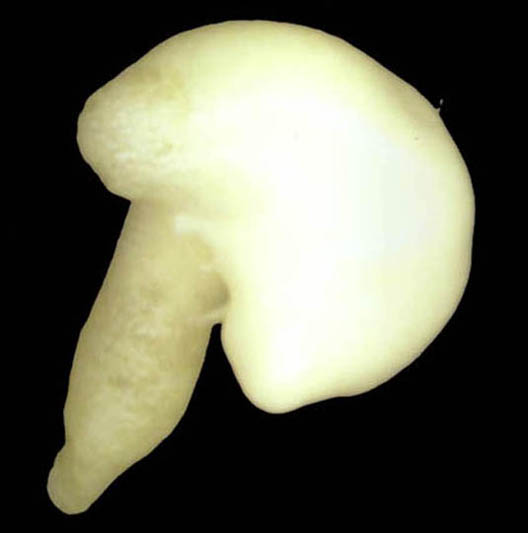 Golden Boy (Stem Cells) #2, 2004-5