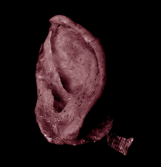 TC&A, in collaboration with Stelarc, ‘Extra Ear ¼ Scale’, 2003