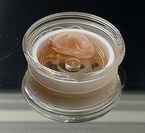TC&A, in collaboration with Stelarc, ‘Extra Ear ¼ Scale’, 2003