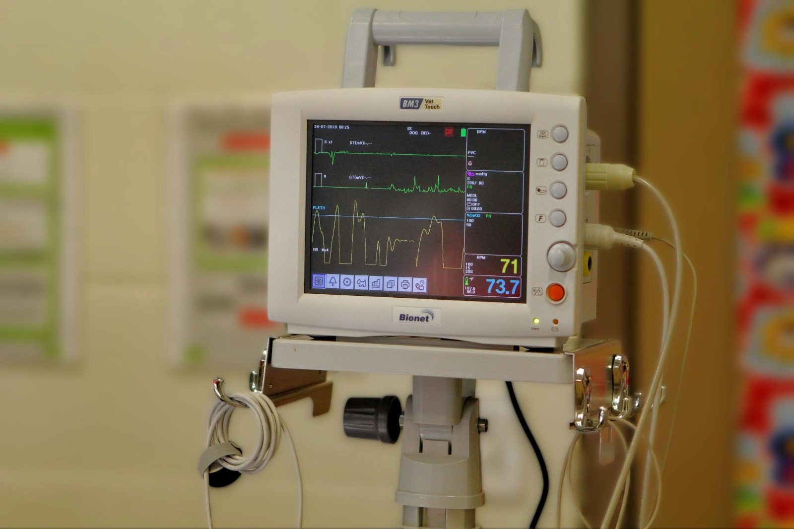 ECG