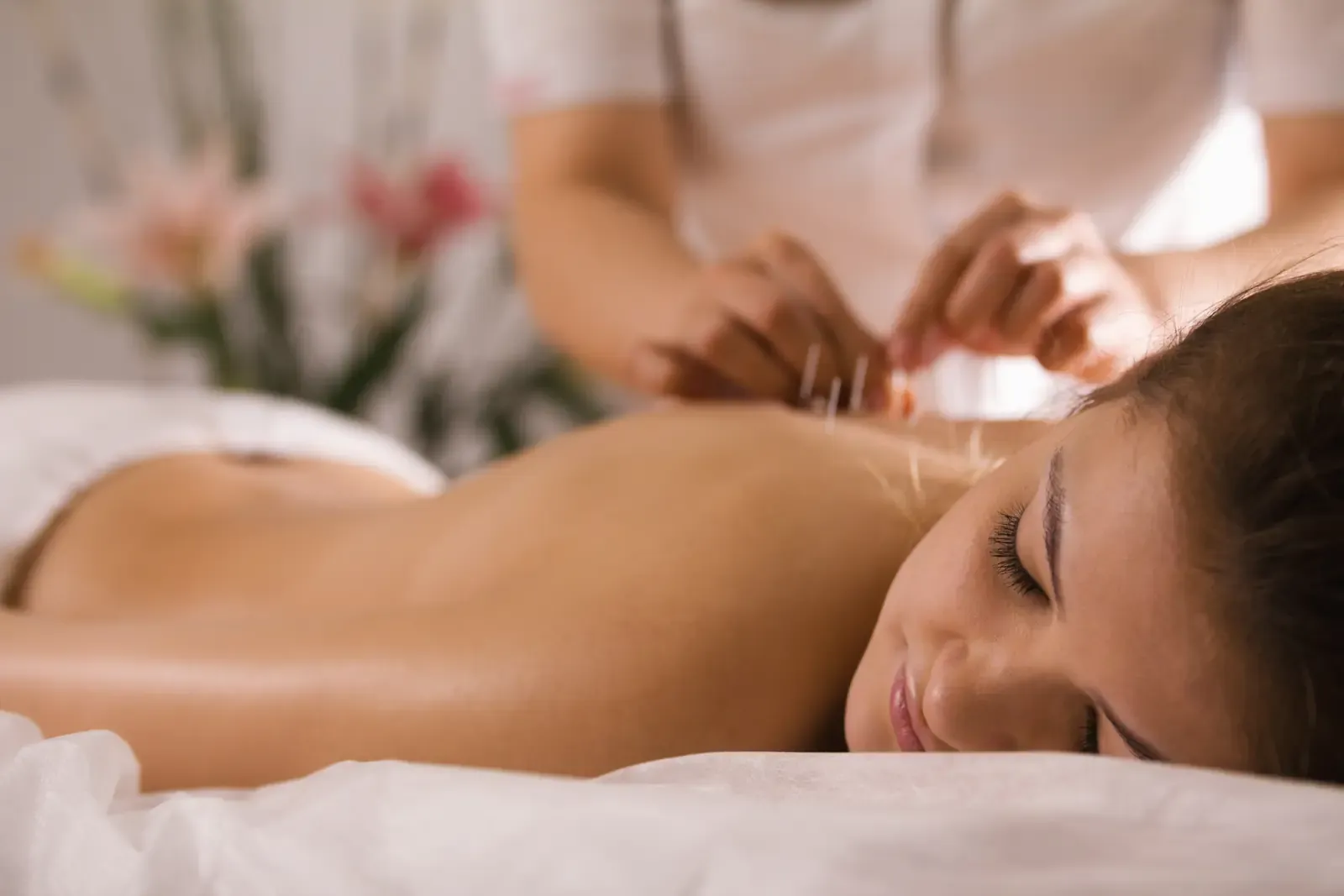 A relaxed client smiling during an acupuncture treatment on her back