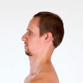 Neck retraction