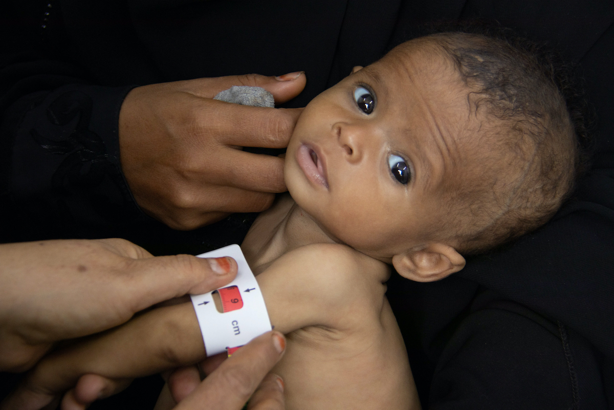 Fatoom's Fight Against Hunger in Yemen