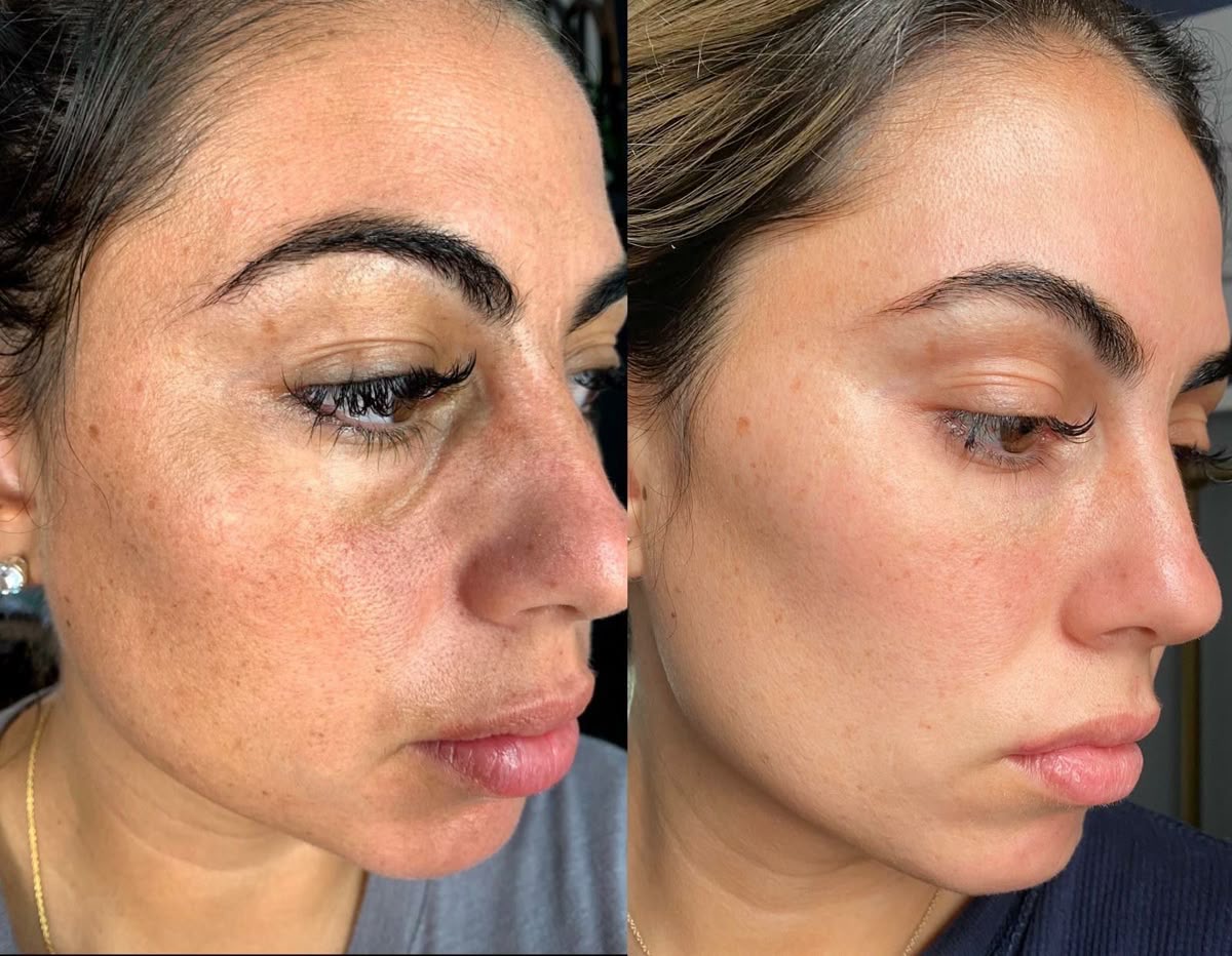 Dull skin and lack of radiance