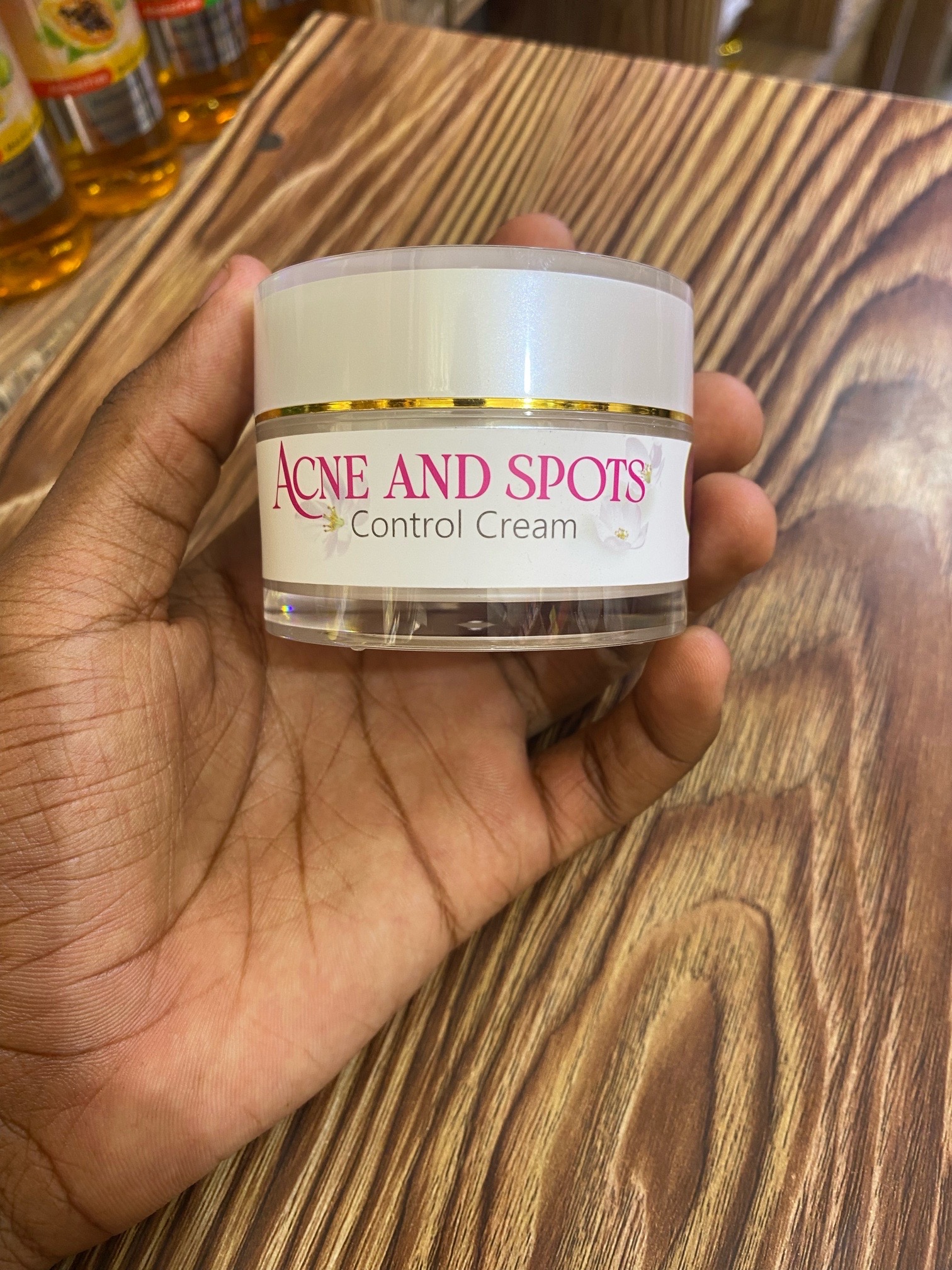 ACNE AND SPOTS