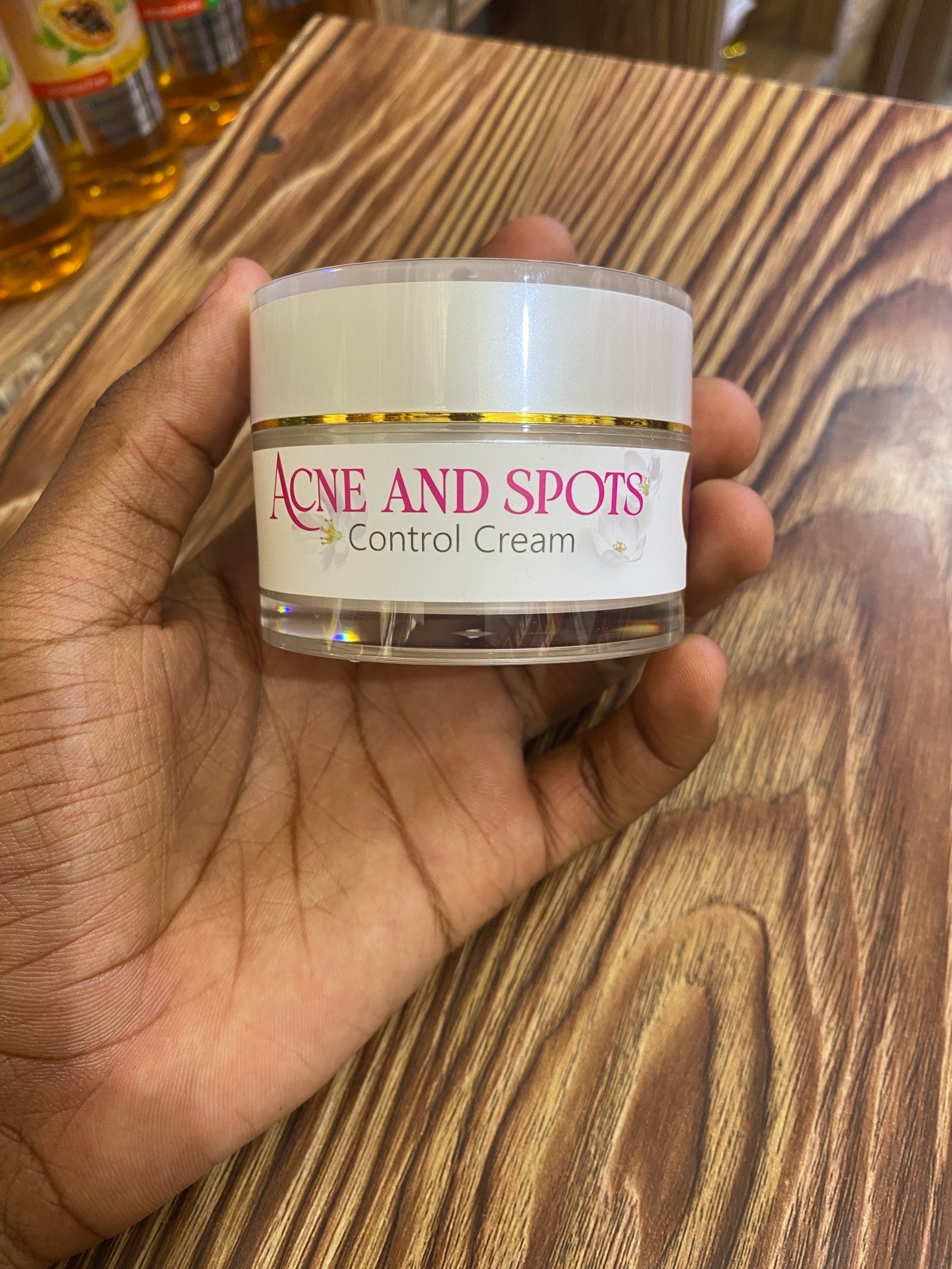 ACNE AND SPOTS thumbnail 2