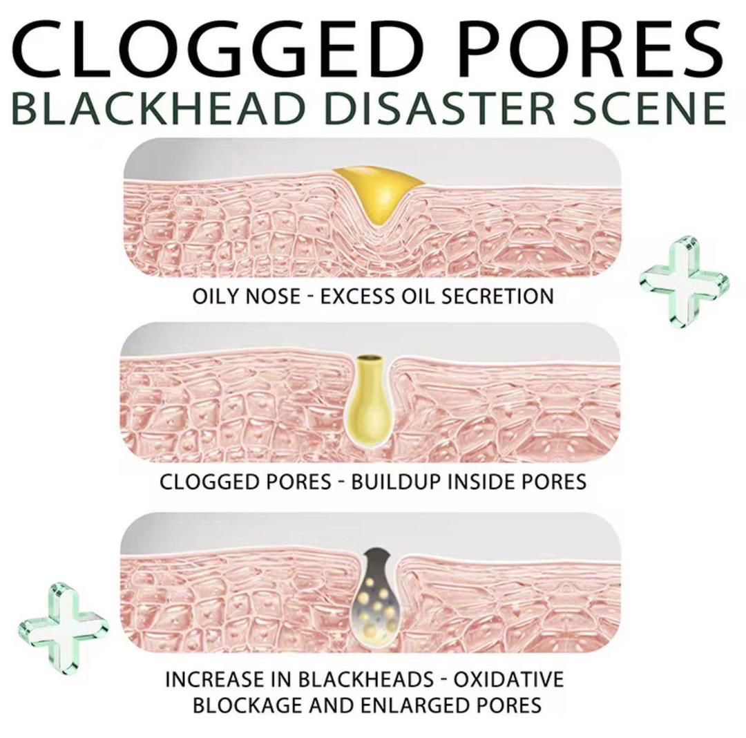 BLACK HEAD EX - CARBON PEEL OFF FACE MASK  thumbnail 2