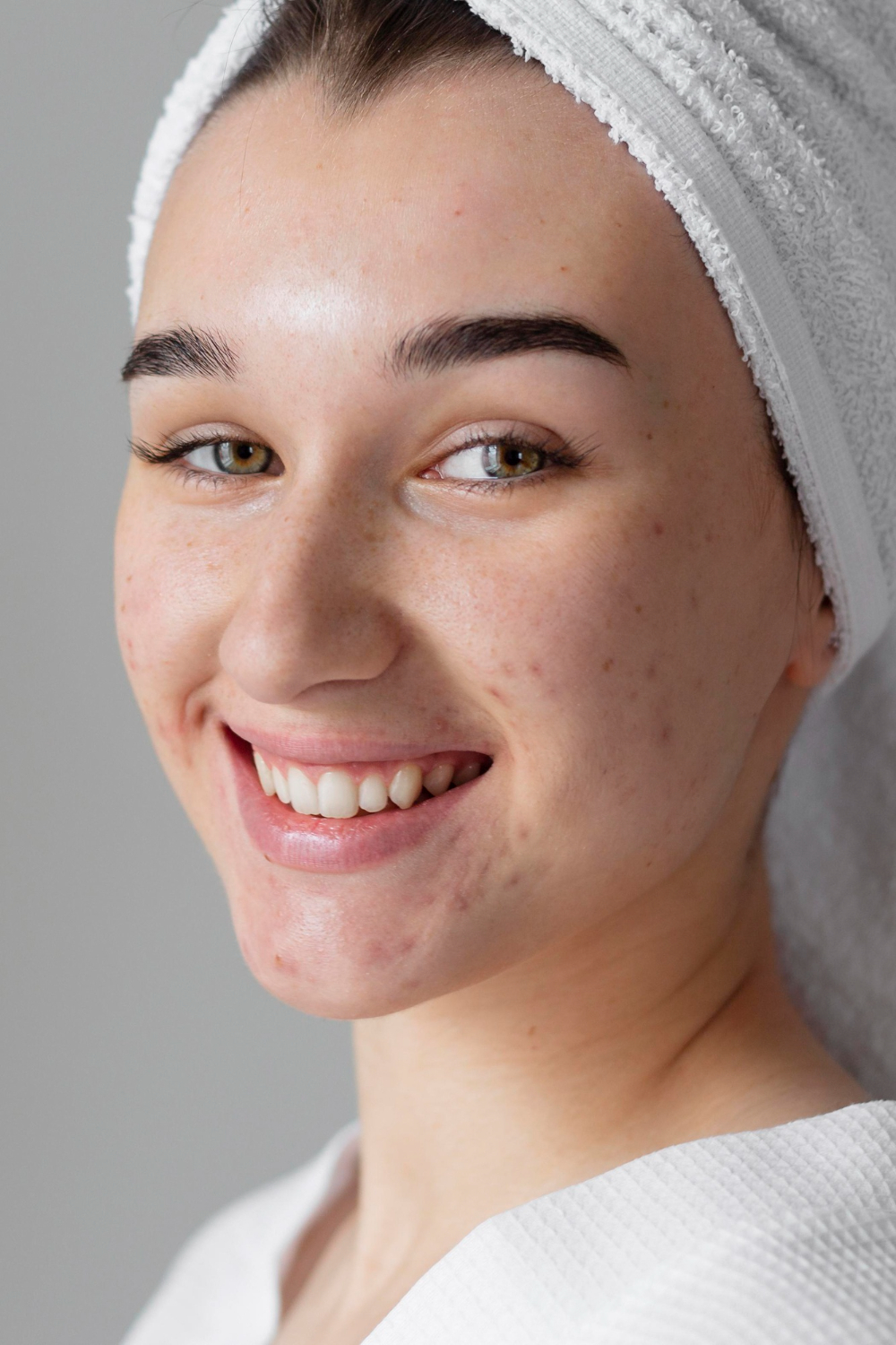 Acne Treatment: A Clear Path to Healthy Skin