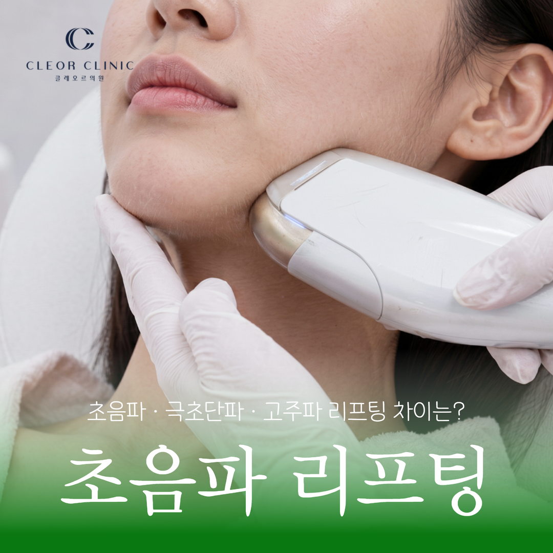 Gangnam Ultrasound Lifting: Ultrasound, Microwave, or RF—Which category is right for your skin?