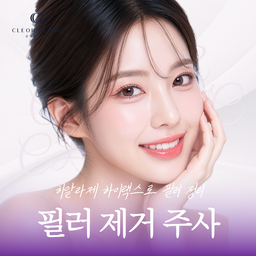 Gangnam Filler Removal Injection: Correcting Misplaced Hyaluronic Acid Fillers with Hyaluronidase (Hilax)