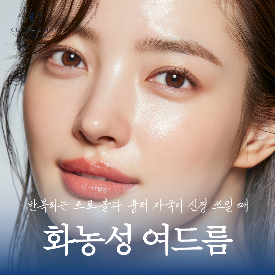 강남 화농성 여드름 원인별 단계적 케어 방향