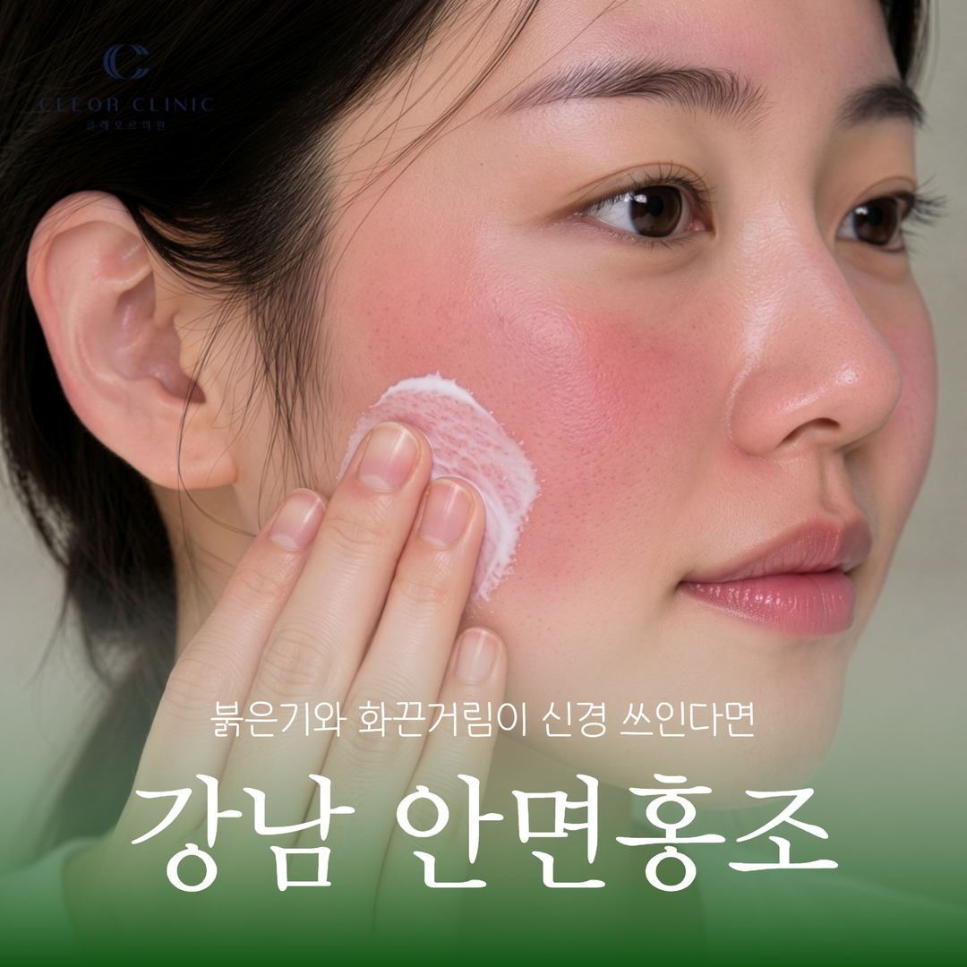 강남 안면홍조 볼 붉은기와 화끈거림이 반복되어 신경 쓰인다면