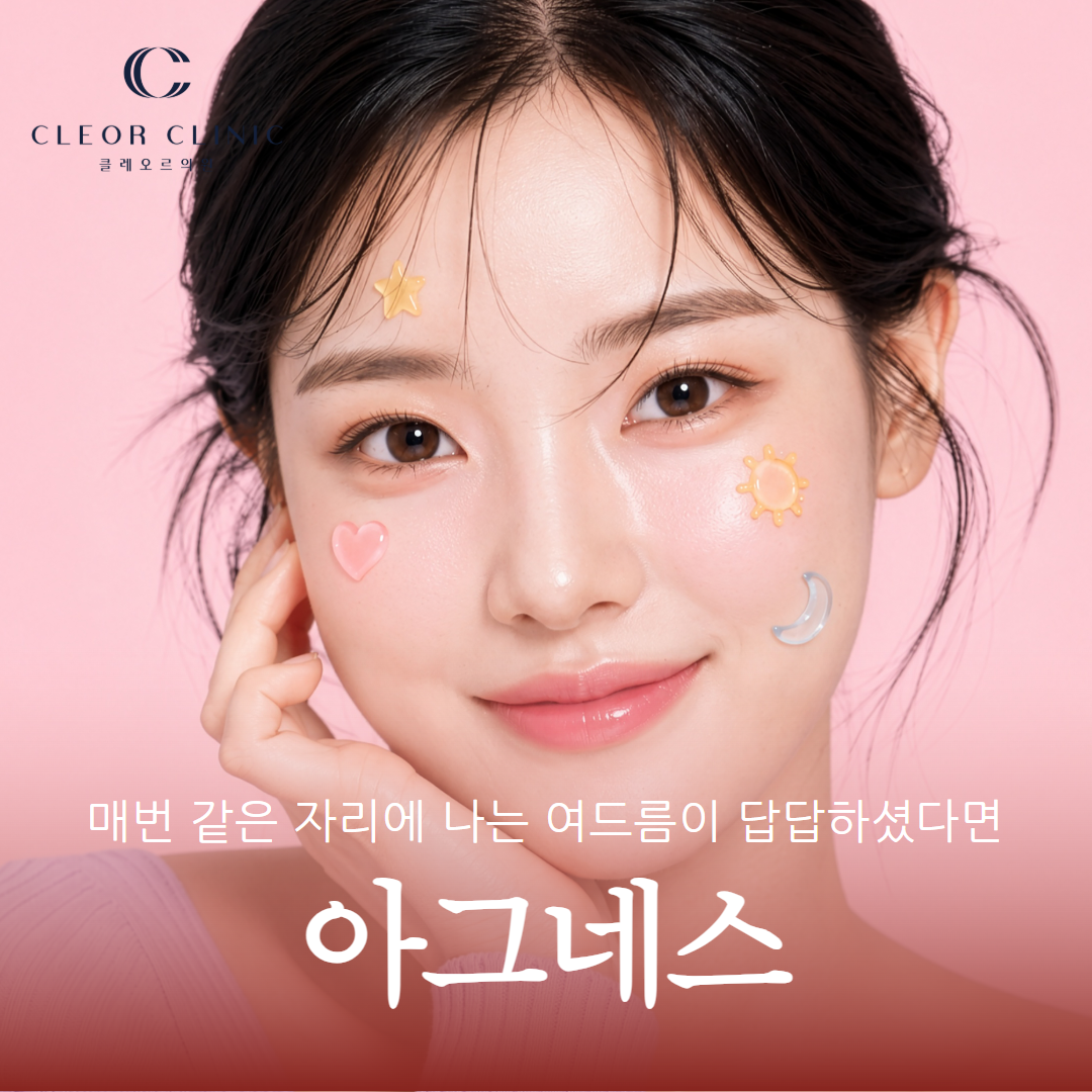 Gangnam Agnes: If you are frustrated by acne that keeps recurring in the same spot