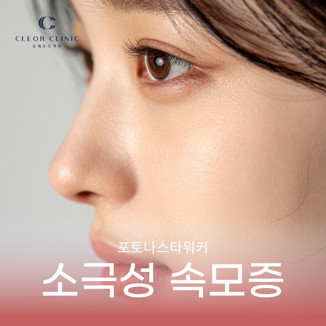 홍대 얼굴제모 코 검은 점이 블랙헤드가 아닐 수 있어요