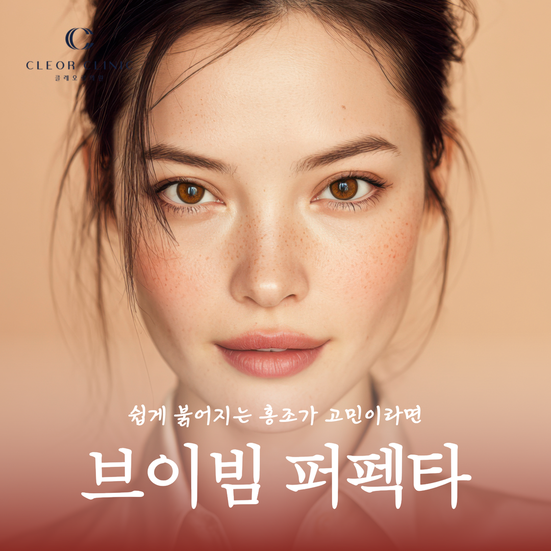 홍대 브이빔 퍼펙타 쉽게 붉어지는 홍조가 고민이라면