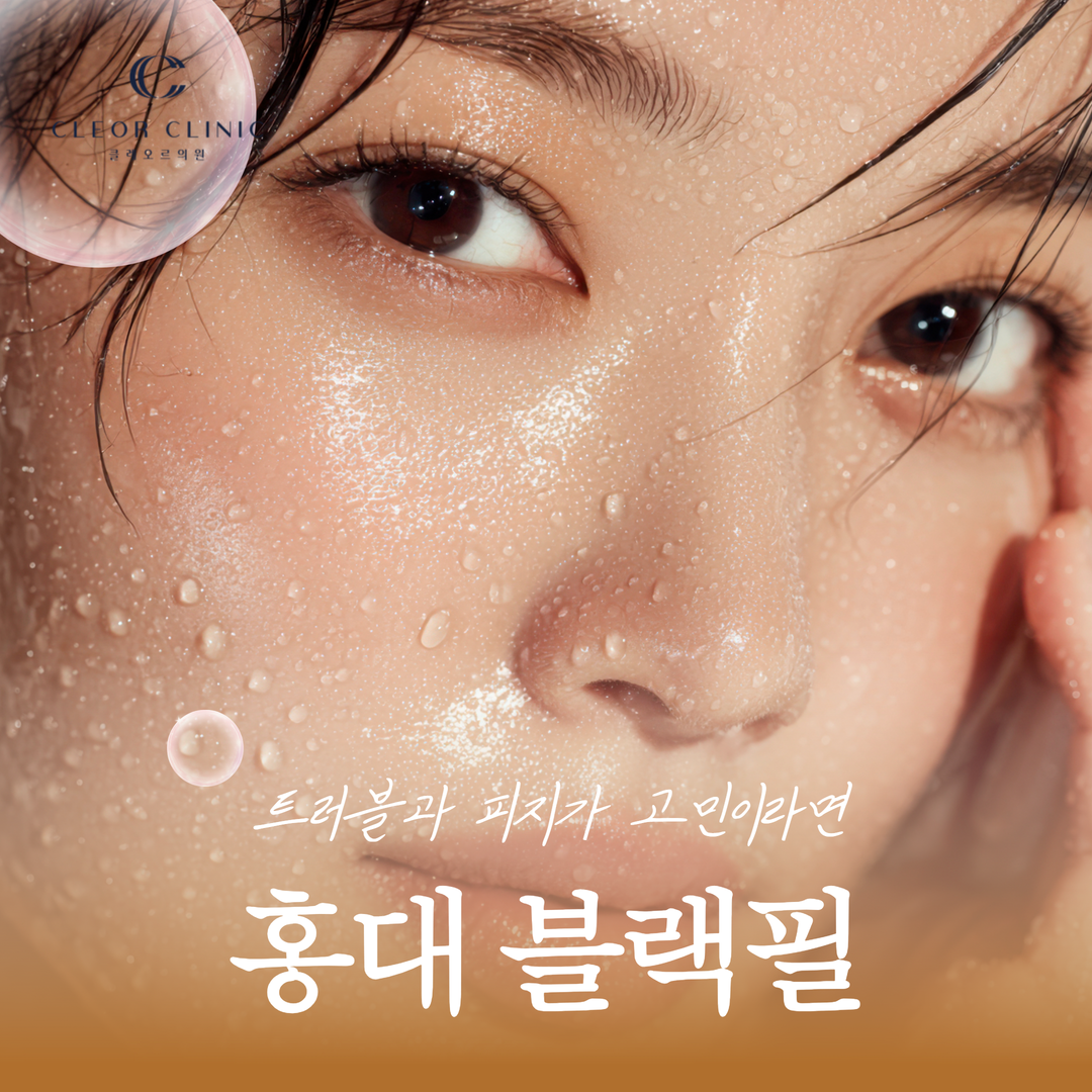 홍대 블랙필 꾸준히 올라오는 트러블과 피지가 고민이라면