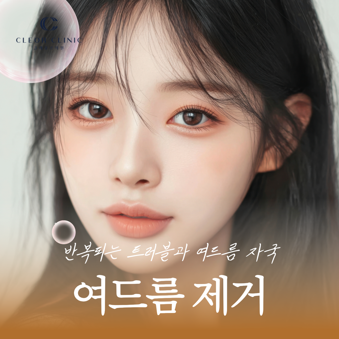 홍대 여드름 반복되는 트러블과 여드름 자국이 스트레스라면