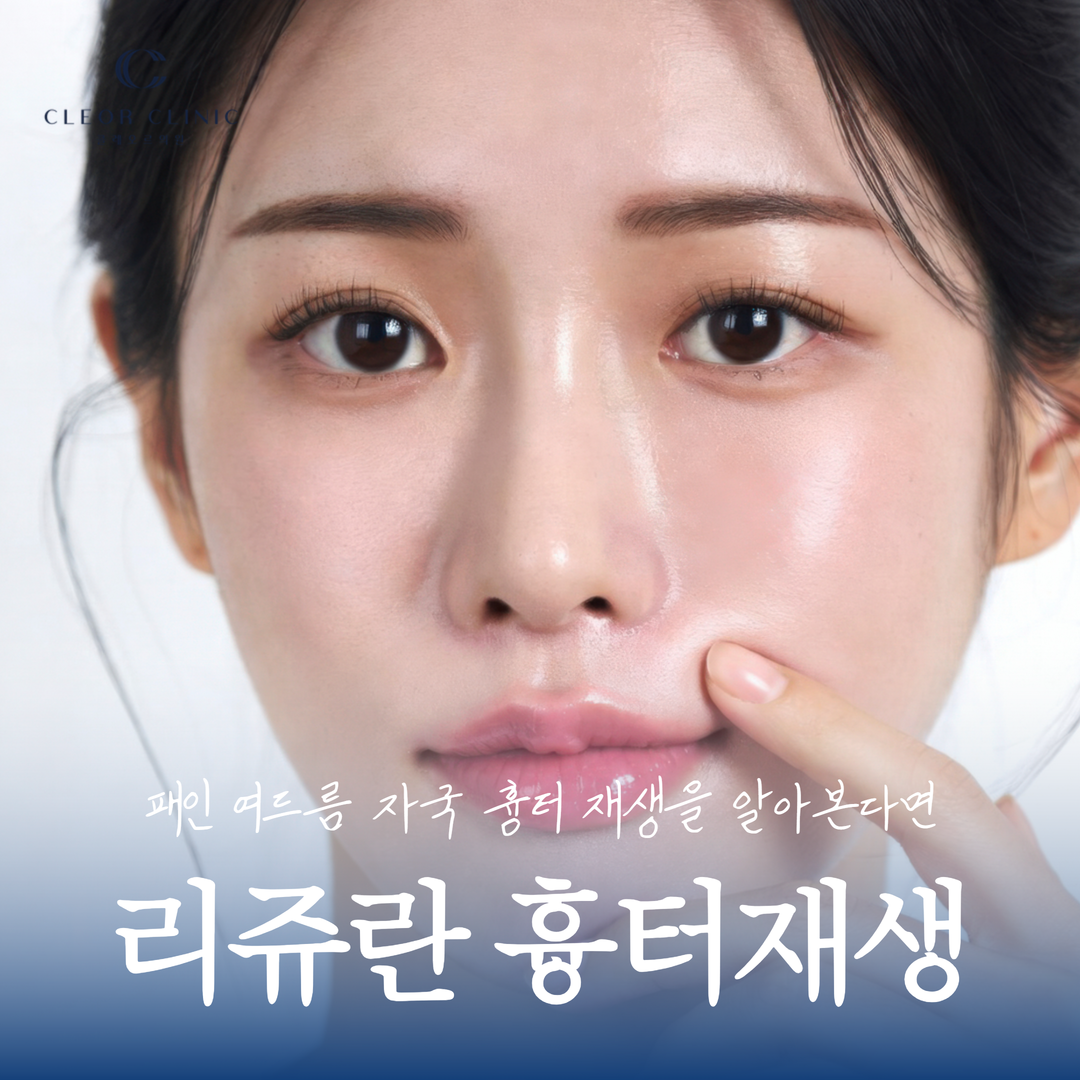 If you are looking for Rejuran S for depressed acne scars and skin regeneration in Hongdae