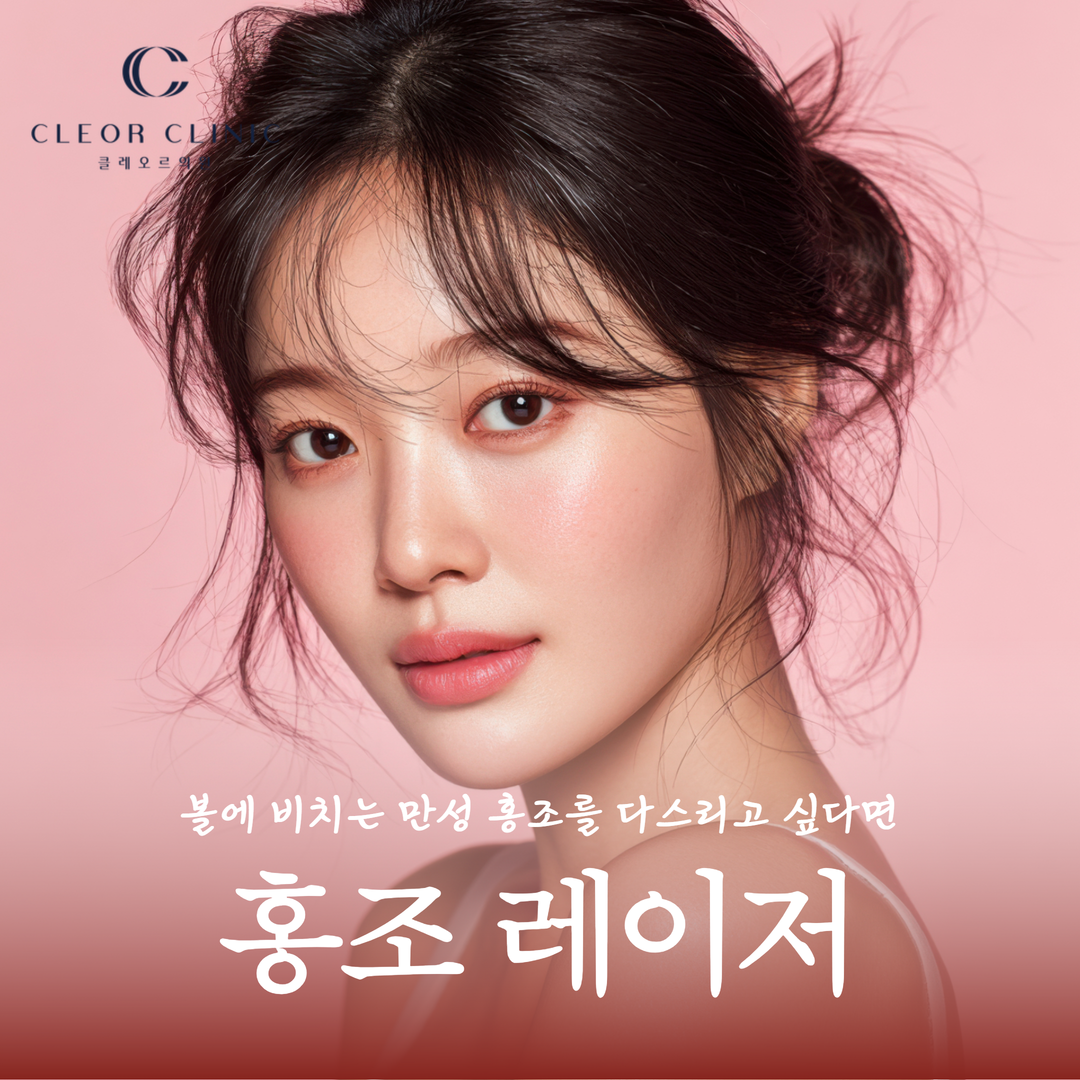 홍대 홍조 제거 브이빔 퍼펙타로 만성 홍조를 다스리고 싶다면