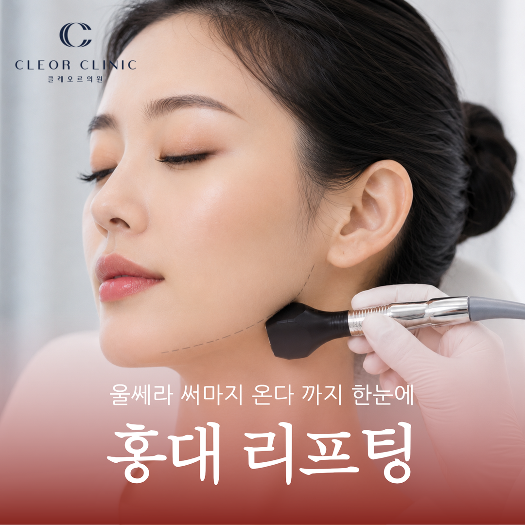 홍대 리프팅 종류 울쎄라 써마지 온다 까지 한눈에 알아보기
