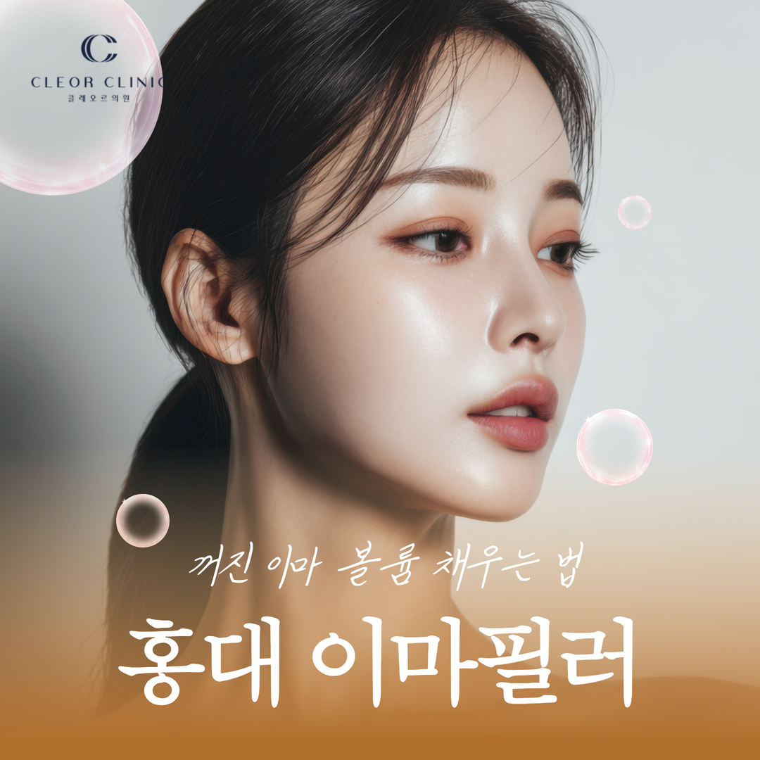 홍대 이마 필러 꺼진 이마 볼륨 채우는 법