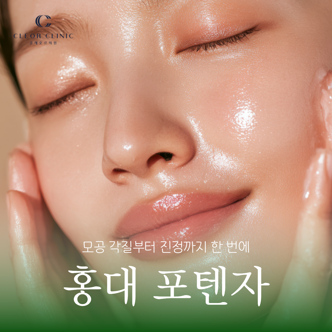 홍대 포텐자 모공과 여드름 흉터 피부결을 함께