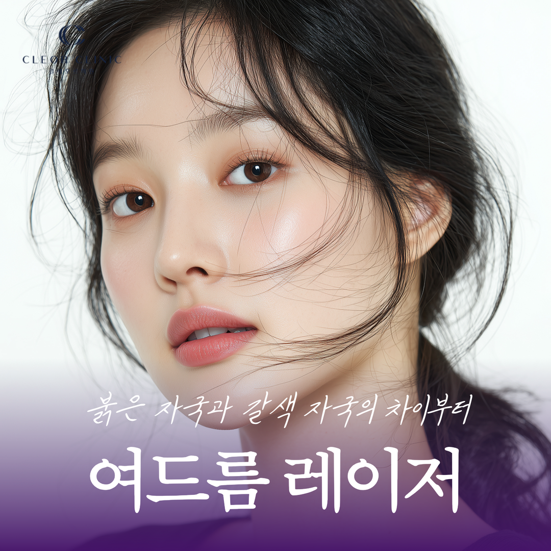홍대 여드름 레이저 붉은 자국과 갈색 자국의 차이부터