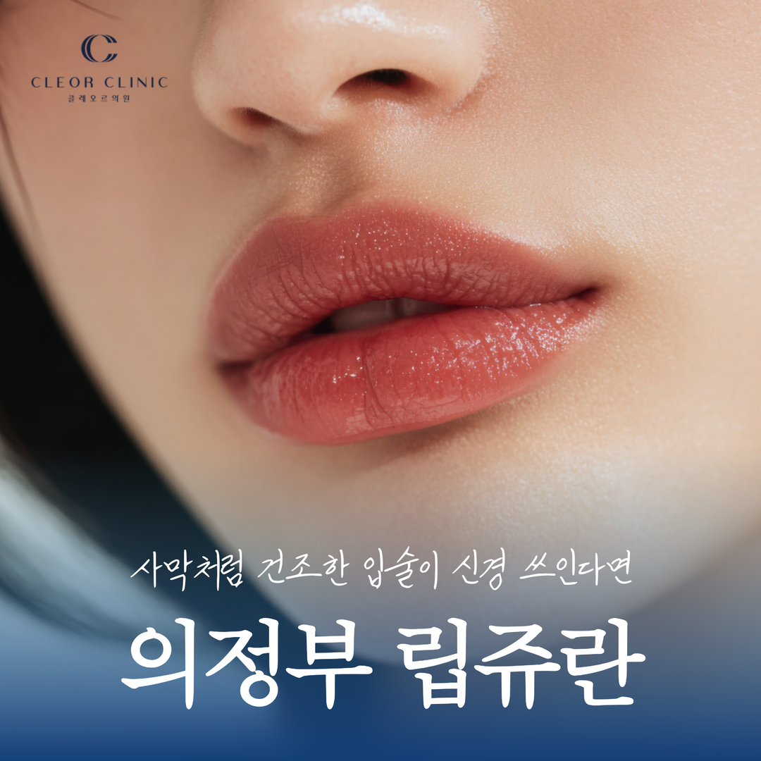 의정부 립쥬란 사막처럼 건조한 입술을 개선 하는 방법