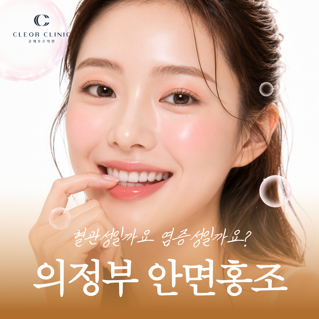 의정부 안면홍조 혈관성일까요 염증성일까요? 홍조 유형별 접근