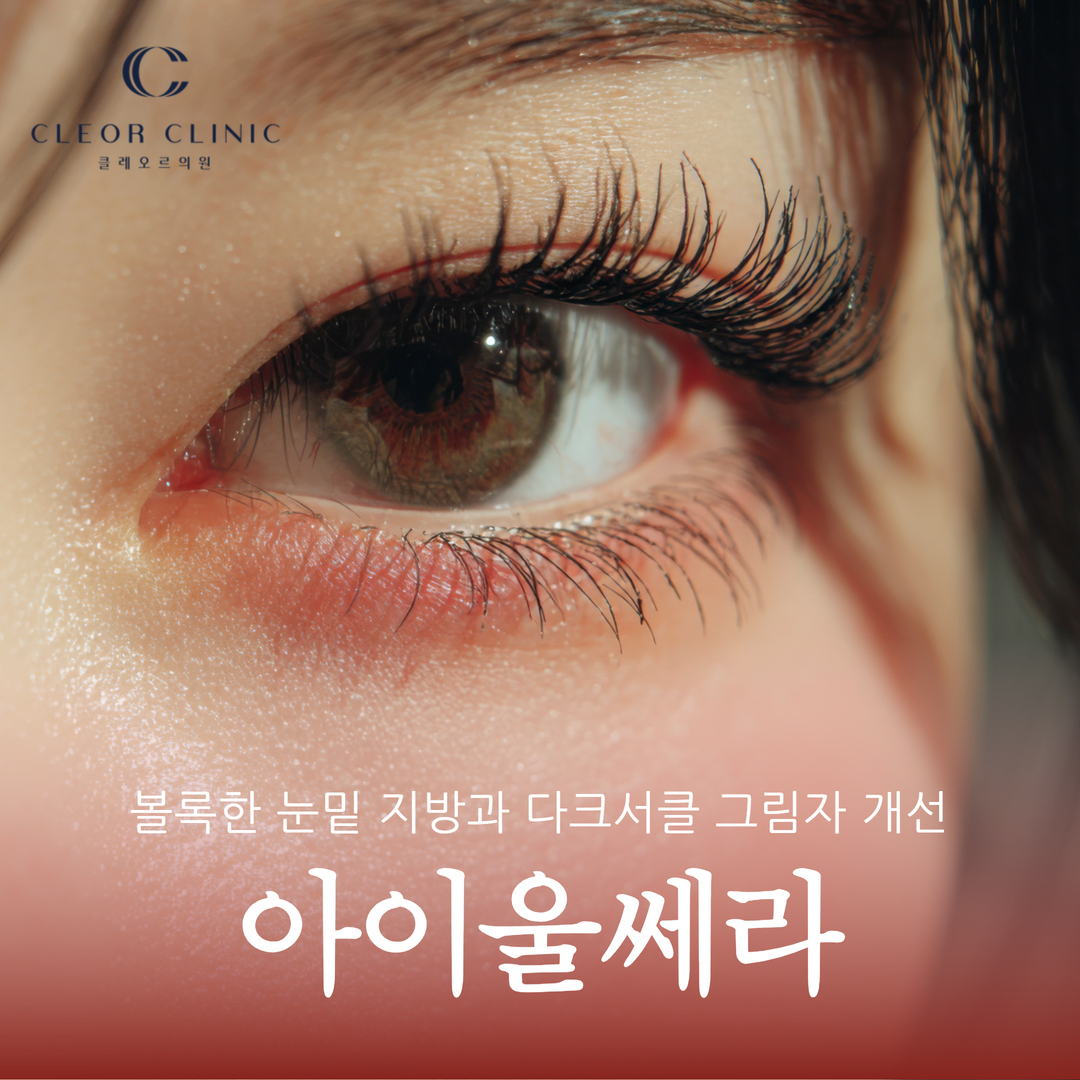 If you are concerned about sunken under-eyes, bulging under-eye fat, and dark circle shadows in Uijeongbu