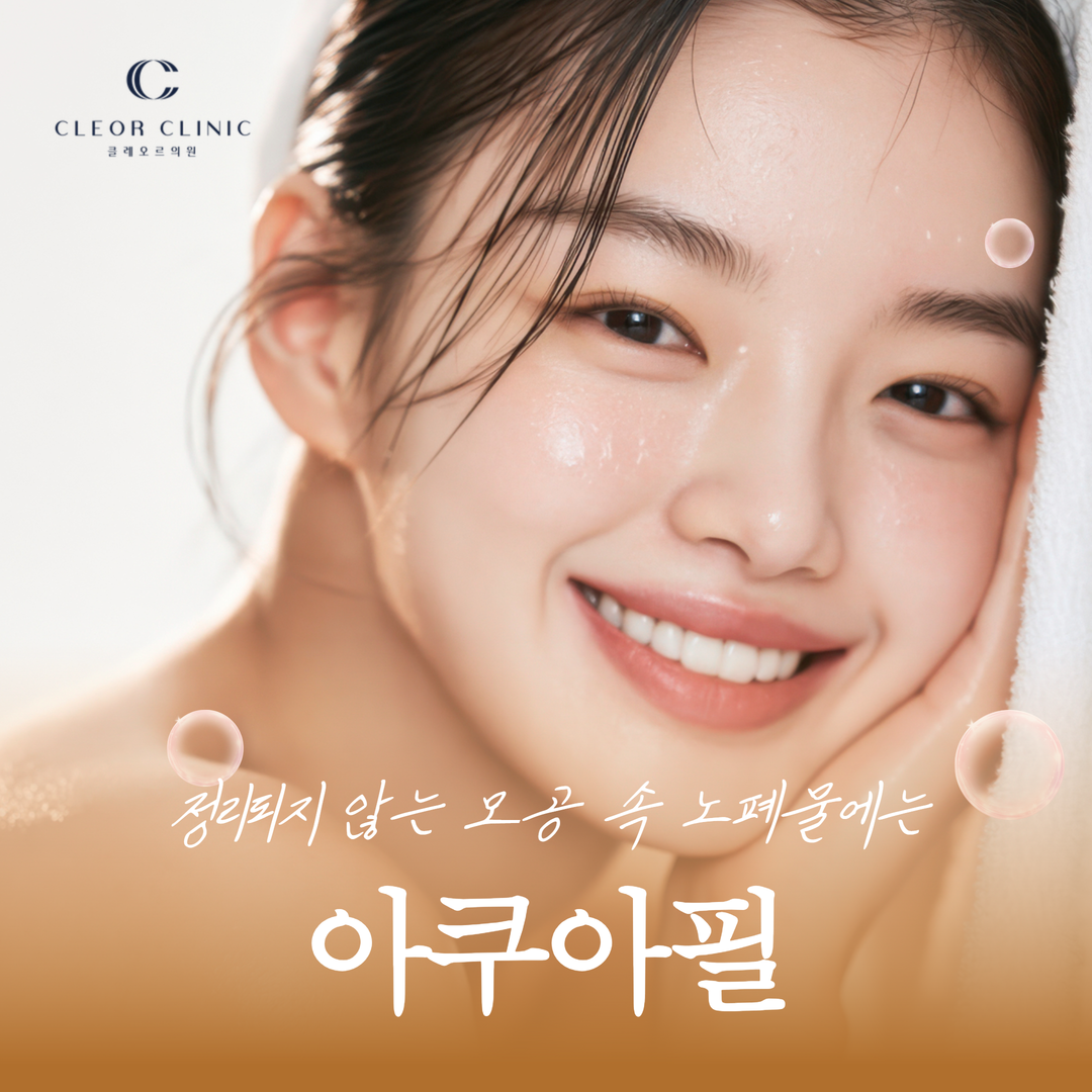 Uijeongbu Aqua Peel: Clearing out pore impurities that cannot be managed with home care