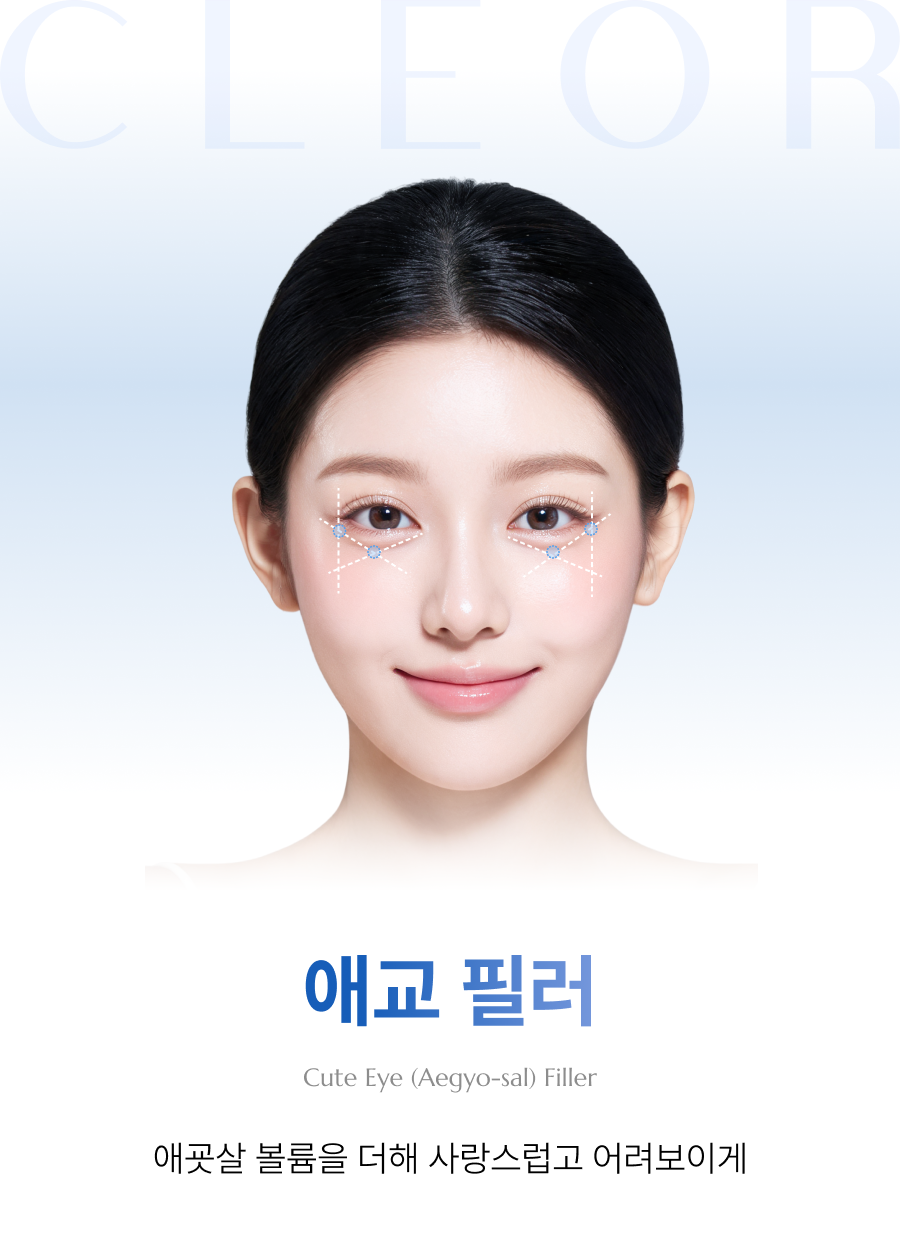 애교필러