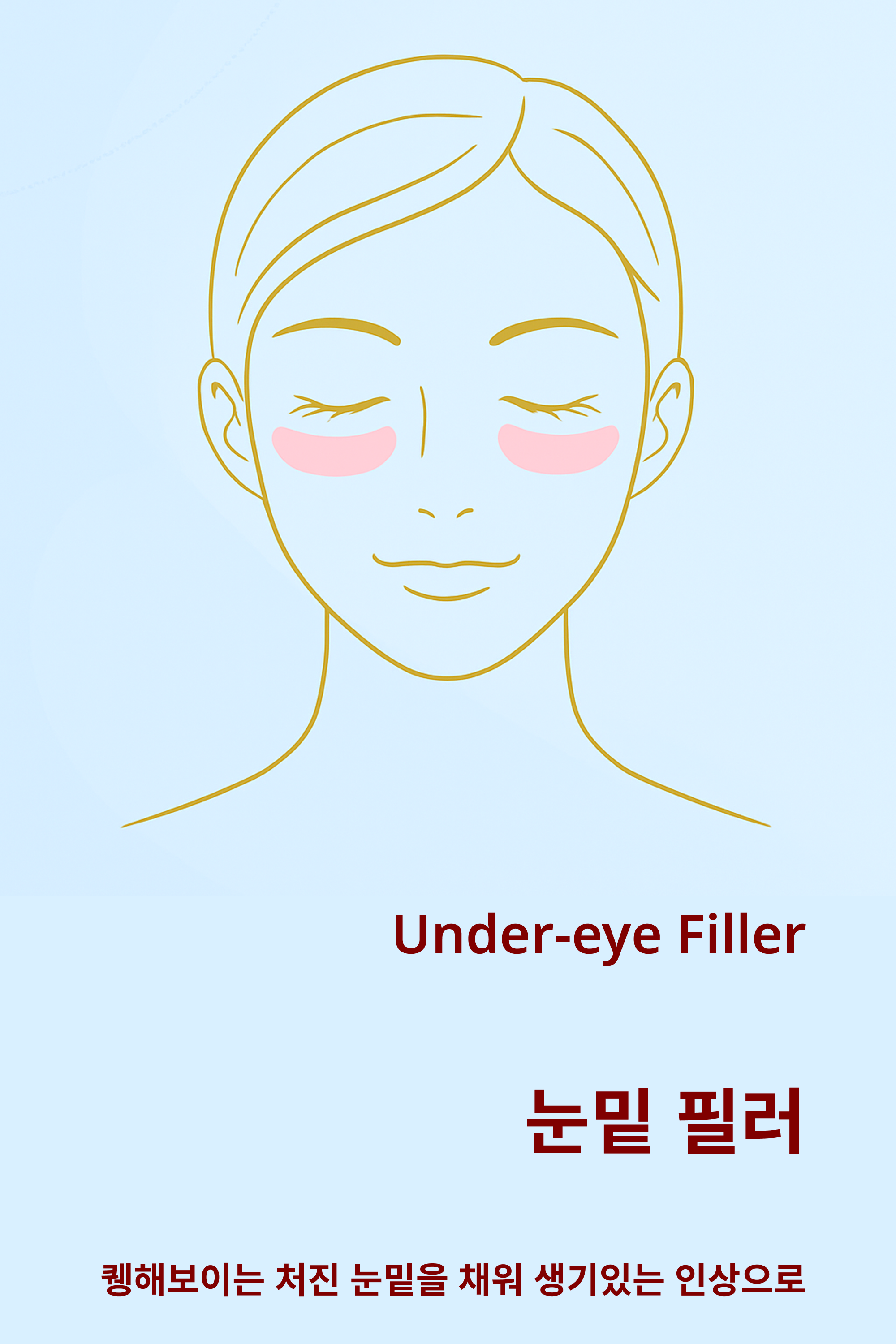 눈밑꺼짐 필러
