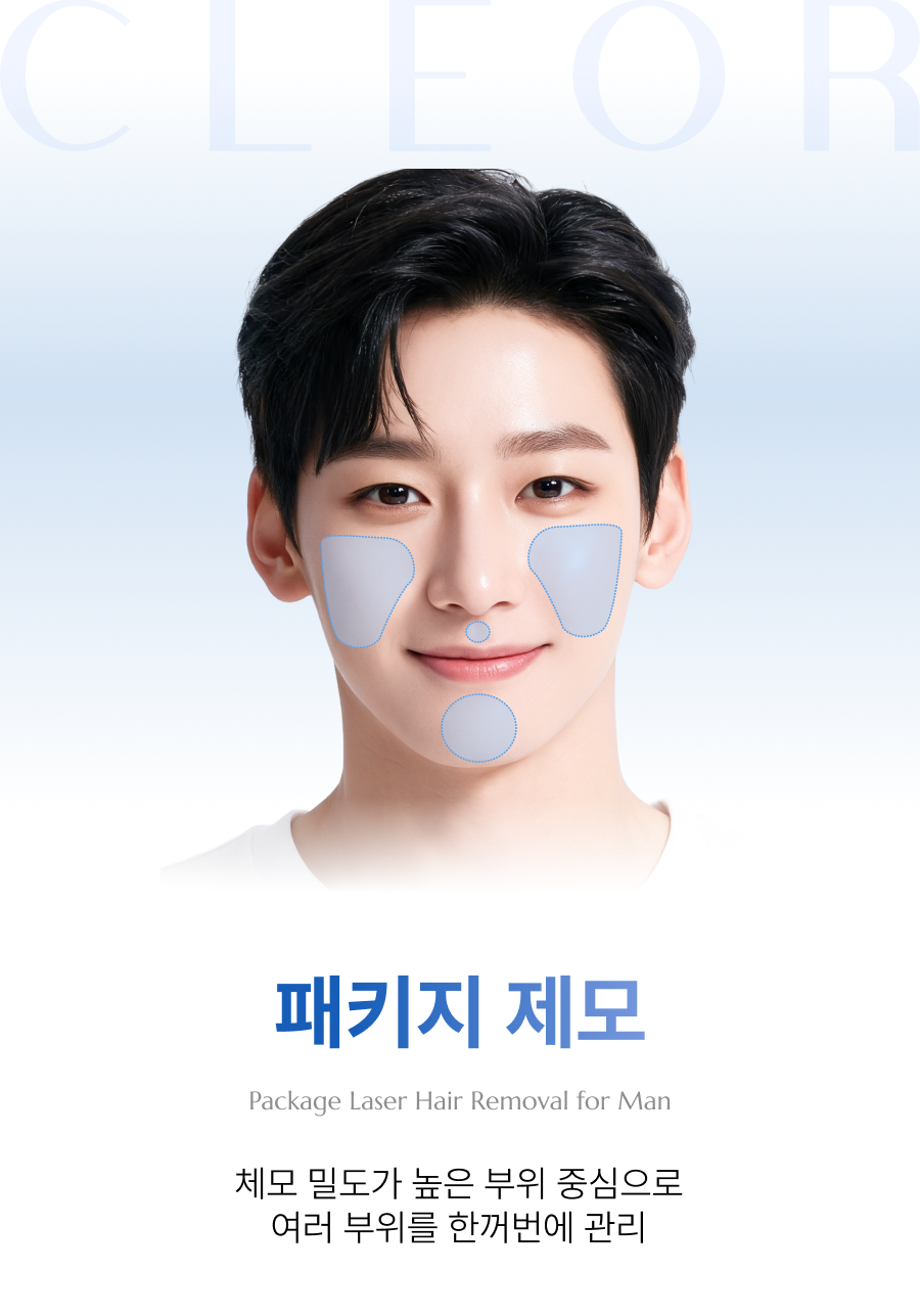 패키지 제모(남성)