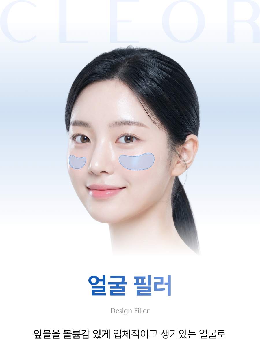 얼굴 필러