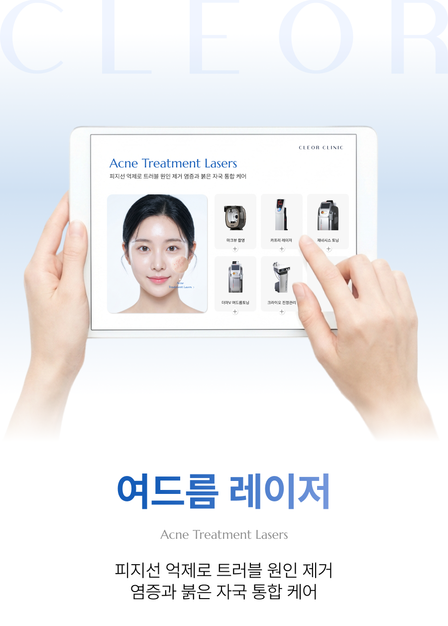 여드름 레이저