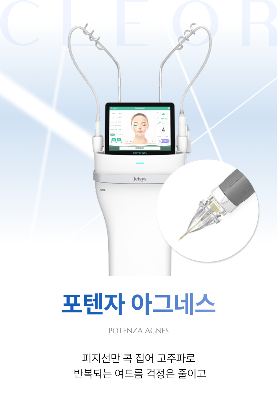 포텐자 아그네스