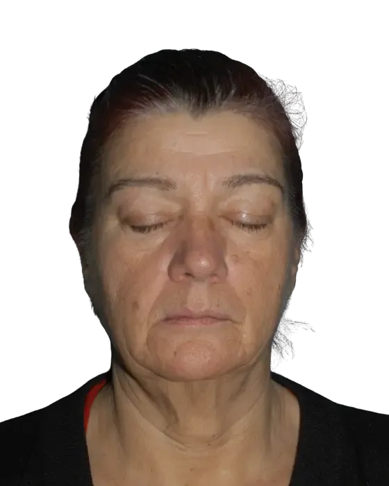 Case 02 before image