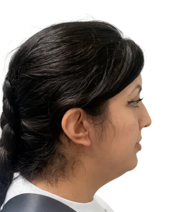 Case 02 before image