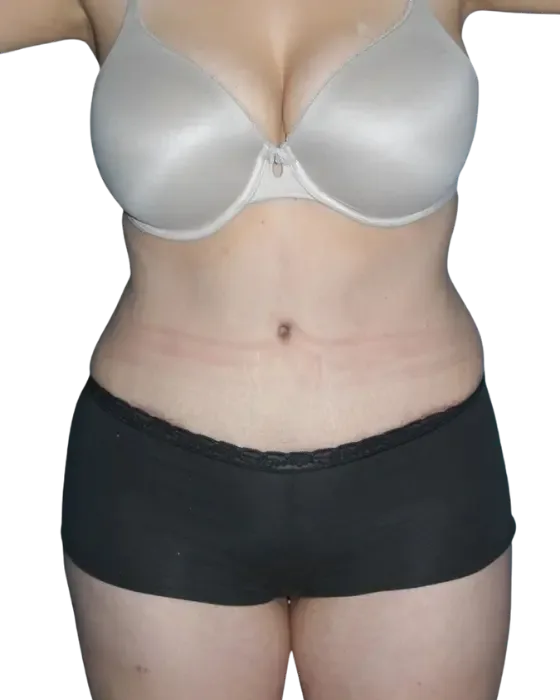 Case 01 after image