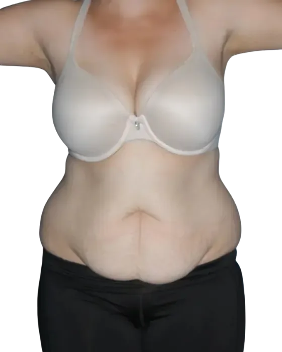 Case 01 before image