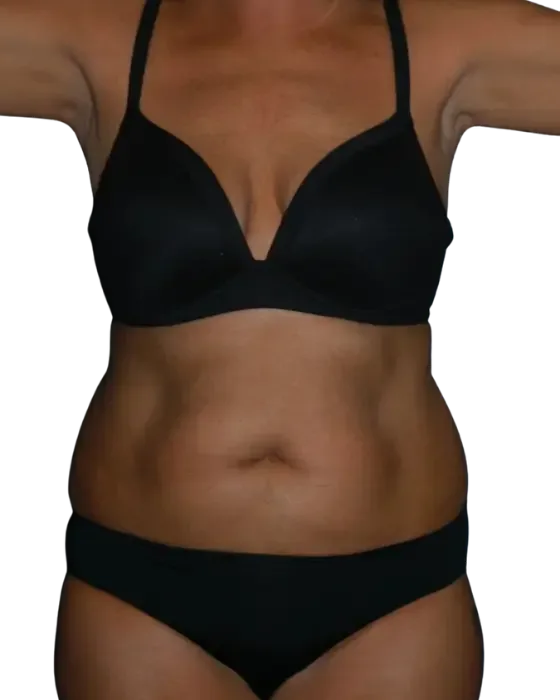 Case 04 before image