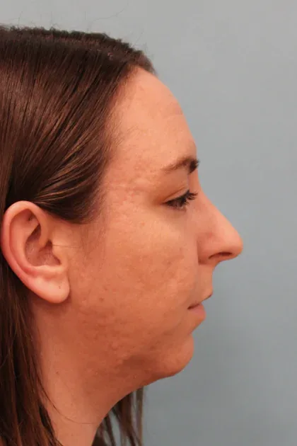 Case 4958 before image