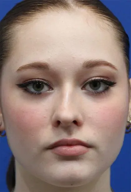 Case 5286 before image
