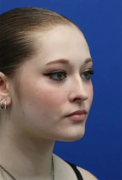 Case 5286 before image