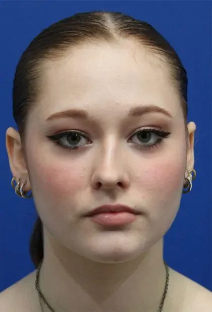 Case 5286 before image