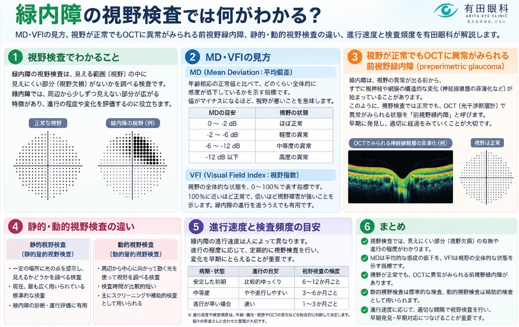 緑内障の視野検査について解説するタイトル画像