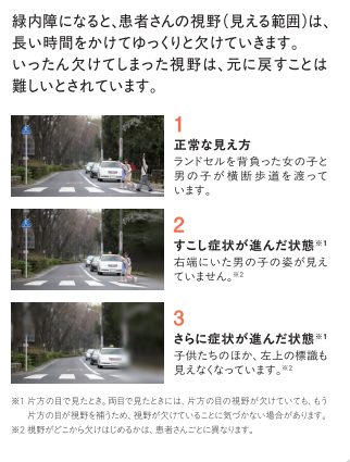 道路風景を用いて視野障害の見え方を説明した参考図